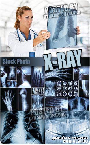 Рентген - Растровый клипарт